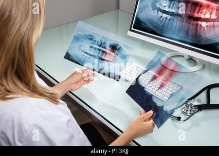 Close-up of a female Dentist à dents à X-ray en clinique Banque D'Images