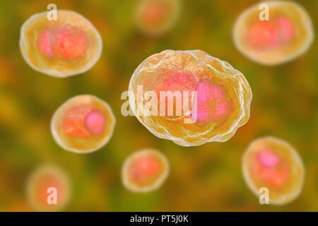 Chlamydia trachomatis bactéries. Illustration montrant une inclusion de l'ordinateur composé d'un groupe de corps réticulés chlamydia intracellulaires (stade, multipliant les petites sphères orange) près du noyau (rose) d'une cellule. Chlamydia trachomatis provoque une infection transmise sexuellement qui peut passer inaperçue provoquant l'infertilité. Il provoque aussi la maladie de l'oeil le trachome, qui peut conduire à la cécité. Banque D'Images