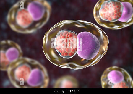 Chlamydia trachomatis bactéries. Illustration montrant une inclusion de l'ordinateur composé d'un groupe de corps réticulés chlamydia intracellulaires (stade, multipliant les petites sphères rouges) près du noyau (violet) d'une cellule. Chlamydia trachomatis provoque une infection transmise sexuellement qui peut passer inaperçue provoquant l'infertilité. Il provoque aussi la maladie de l'oeil le trachome, qui peut conduire à la cécité. Banque D'Images