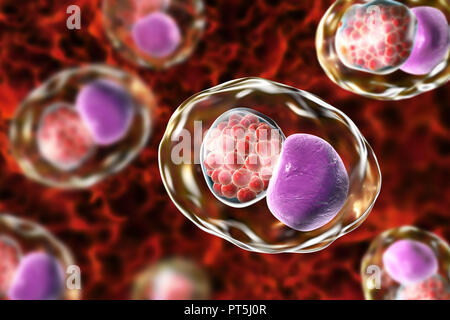 Chlamydia trachomatis bactéries. Illustration montrant une inclusion de l'ordinateur composé d'un groupe de corps réticulés chlamydia intracellulaires (stade, multipliant les petites sphères rouges) près du noyau (violet) d'une cellule. Chlamydia trachomatis provoque une infection transmise sexuellement qui peut passer inaperçue provoquant l'infertilité. Il provoque aussi la maladie de l'oeil le trachome, qui peut conduire à la cécité. Banque D'Images