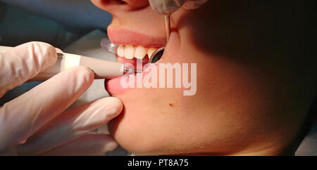 Jeune fille a ses dents nettoyées par une hygiéniste dentaire chez le dentiste. Autorisation modèle disponible Banque D'Images