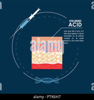 L'acide hyaluronique injection de remplissage infographie Illustration de Vecteur