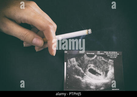 A woman's hand est titulaire d'une cigarette dans le contexte d'une photo de l'uzi de la grossesse, la grossesse et le tabagisme, la gestation Banque D'Images