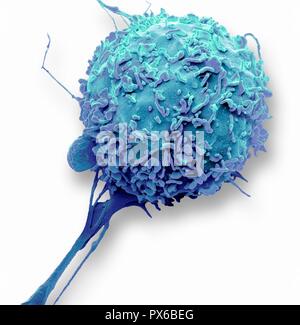 Macrophage. Couleur de l'analyse des électrons Microphotographie (SEM) d'un macrophage globules blancs. Les macrophages sont des cellules du système immunitaire de l'organisme. Ils sont trouvés dans les tissus plutôt que dans le sang circulant. Les macrophages reconnaissent les particules étrangères, y compris les bactéries, le pollen et la poussière, et l'engloutir (phagocytose) et de les digérer. Agrandissement : x4000 lors de l'impression à 10 centimètres de large. Banque D'Images