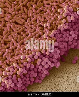 Les bactéries fécales. L'analyse des électrons Microphotographie (SEM) de bactéries cultivées à partir d'un échantillon de fèces humaines. Au moins 50 pour cent de matières fécales humaines est composé de bactéries jeter de l'intestin. Un grand nombre de ces bactéries sont une partie normale de la flore dans les intestins et sont bénéfiques pour la digestion. Cependant, certains sont pathogènes, tels que Salmonella enterica et certaines souches de Escherichia coli, qui peut causer des maladies. Agrandissement : x6000 lors de l'impression 10 centimètres de large Banque D'Images