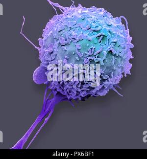 Macrophage. Couleur de l'analyse des électrons Microphotographie (SEM) d'un macrophage globules blancs. Les macrophages sont des cellules du système immunitaire de l'organisme. Ils sont trouvés dans les tissus plutôt que dans le sang circulant. Les macrophages reconnaissent les particules étrangères, y compris les bactéries, le pollen et la poussière, et l'engloutir (phagocytose) et de les digérer. Agrandissement : x4000 lors de l'impression à 10 centimètres de large. Banque D'Images