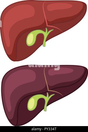 Illustration du foie cirrhose et sain Illustration de Vecteur