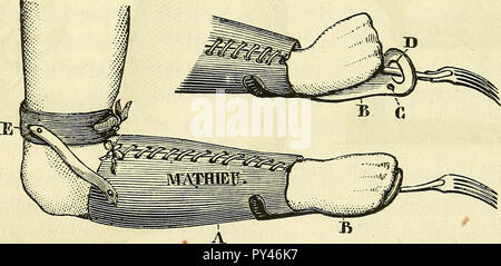 Arsenal de la chirurgie contemporaine : description, mode d'emploi, et appréciation des appareils et instruments internationaux en usage pour le diagnostic et le traitement des maladies chirurgicales, l'orthopédie, la prothése, les opérations simples, générales, spéciales et obstétricales Banque D'Images