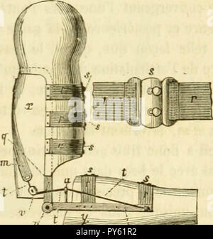 Arsenal de la chirurgie contemporaine : description, mode d'emploi, et appréciation des appareils et instruments internationaux en usage pour le diagnostic et le traitement des maladies chirurgicales, l'orthopédie, la prothése, les opérations simples, générales, spéciales et obstétricales Banque D'Images