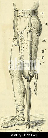 Arsenal de la chirurgie contemporaine : description, mode d'emploi, et appréciation des appareils et instruments internationaux en usage pour le diagnostic et le traitement des maladies chirurgicales, l'orthopédie, la prothése, les opérations simples, générales, spéciales et obstétricales Banque D'Images