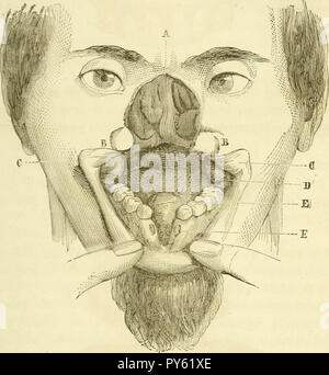 Arsenal de la chirurgie contemporaine : description, mode d'emploi, et appréciation des appareils et instruments internationaux en usage pour le diagnostic et le traitement des maladies chirurgicales, l'orthopédie, la prothése, les opérations simples, générales, spéciales et obstétricales Banque D'Images