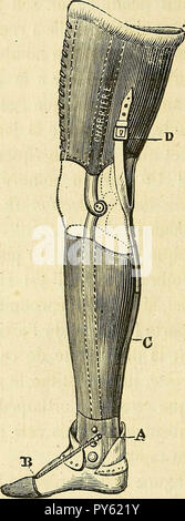 Arsenal de la chirurgie contemporaine : description, mode d'emploi, et appréciation des appareils et instruments internationaux en usage pour le diagnostic et le traitement des maladies chirurgicales, l'orthopédie, la prothése, les opérations simples, générales, spéciales et obstétricales Banque D'Images