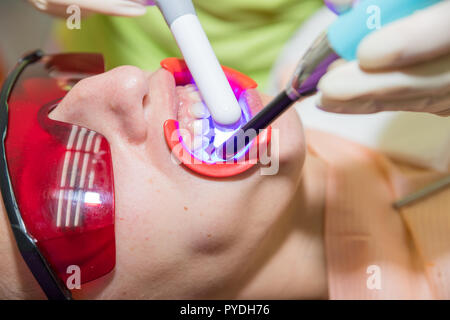 Patient Dans La Clinique Dentaire Lampe Uv De Blanchiment Des Dents Avec  Composition Photopolymère Jeune Femme Pendant La Procédure De Blanchiment  Des Dents Avec Durcissement De La Lumière Uv Au Cabinet Du