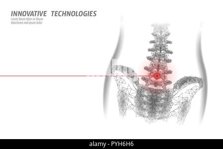 Les droits de la colonne vertébrale lombaire douleur hanche radiculite basse poly. Triangle particules polygonales géométrique point line Technologie de médecine future blanc rouge région douloureuse vector illustration Illustration de Vecteur