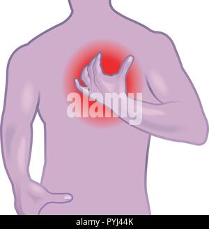 Silhouette of man montrant des signes d'état de santé illustrées sur l'infarctus blanc. Illustration de Vecteur