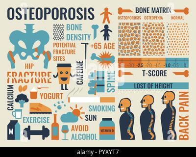 Illustration de l'ostéoporose et l'icône infographie concept éléments Illustration de Vecteur