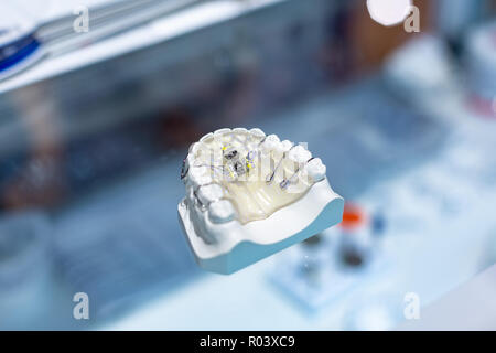 Outils d'Orthodontie Dentaire. Appareil multi-couleur pour faire une dent moulée. Dents de moulage. Banque D'Images