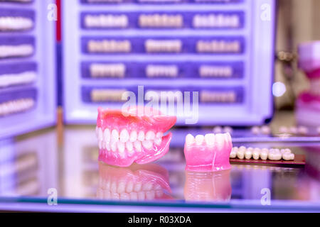 Orthodontie appareil dentaire. Outils pour faire une prothèse dentaire, dents moulées. Dents de moulage. Banque D'Images