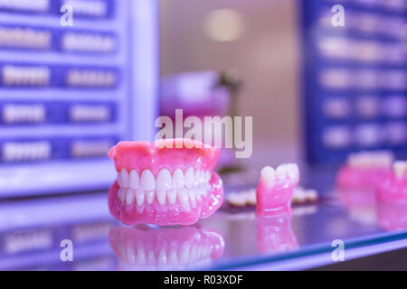 Orthodontie appareil dentaire. Outils pour faire une prothèse dentaire, dents moulées. Dents de moulage. Banque D'Images