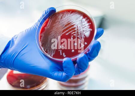 Assistant de laboratoire l'examen de la croissance sur une boîte de pétri, Close up. Banque D'Images