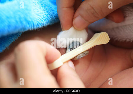 Le nettoyage du cordon ombilical du bébé,Close-up macro photographie. Banque D'Images