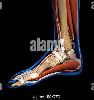 X-ray medial view of a woman's foot. Banque D'Images