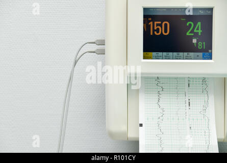 Surveiller pour mesurer les contractions, coeur d'une femme enceinte dans un hôpital Banque D'Images