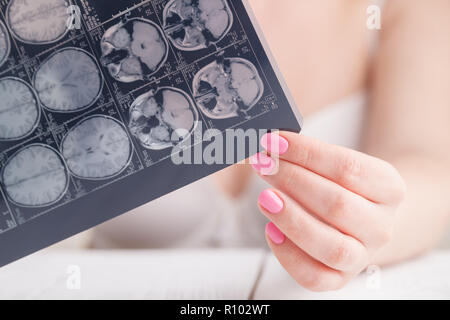 Woman hand holding cerveau IRM film à voir pour le diagnostic et le rapport. Concept médical Banque D'Images