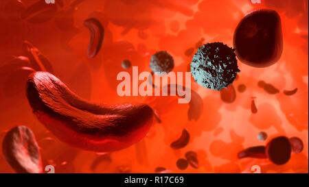 La drépanocytose. Illustration montrant les cellules de sang blanches (rond, blanc), les globules rouges normaux (rond), et les globules rouges affectées par l'anémie falciforme (en forme de croissant). C'est une maladie dans laquelle les globules rouges contiennent une forme anormale de l'hémoglobine du sang (pigment) qui transporte l'oxygène qui cause les cellules de sang pour devenir en forme de faucille, plutôt que ronde. Les drépanocytes ne peuvent pas se déplacer à travers les vaisseaux sanguins aussi facilement que les cellules normales et peut donc causer des blocages. Ceci empêche l'oxygène d'atteindre les tissus, ce qui provoque des douleurs et des lésions aux organes. Banque D'Images