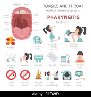 Amygdales et de la gorge. Les symptômes de la pharyngite, icône de traitement défini. Conception infographique médical. Vector illustration Illustration de Vecteur