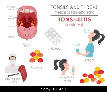 Amygdales et de la gorge. Les symptômes de l'amygdalite, icône de traitement défini. Conception infographique médical. Vector illustration Illustration de Vecteur