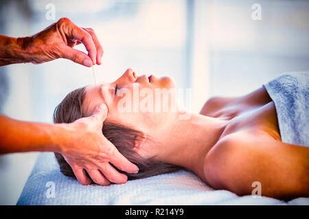 Femme qui reçoit un traitement d'acupuncture Banque D'Images