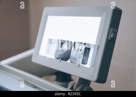 X-ray photo sur led arrière-plan. Les soins dentaires, l'hygiène dentaire, checkup et concept de thérapie. Ton blanc Banque D'Images