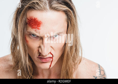 Close up of angry man avec blessures sanglantes sur le visage isolated on white Banque D'Images