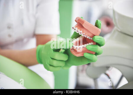Le dentiste démontre comment les accolades sont corriger les dents à l'aide d'un modèle de la mâchoire artificielle Banque D'Images