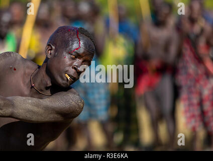 Suri guerrier de la tribu des saignements durant un donga stick fighting rituel, vallée de l'Omo, Kibish, Ethiopie Banque D'Images