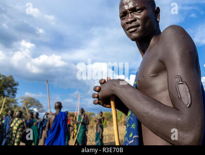 Avec un guerrier de la tribu Suri la scarification sur le bras pendant un donga stick fighting rituel, vallée de l'Omo, Kibish, Ethiopie Banque D'Images