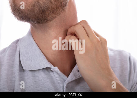 Close-up de la main d'un homme se gratte la Cou Banque D'Images