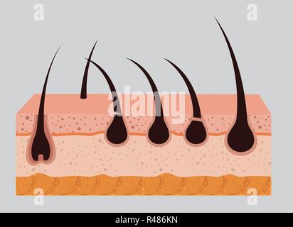 Couches de la structure de la peau avec des icônes d'enlèvement de cheveux vector illustration design Illustration de Vecteur