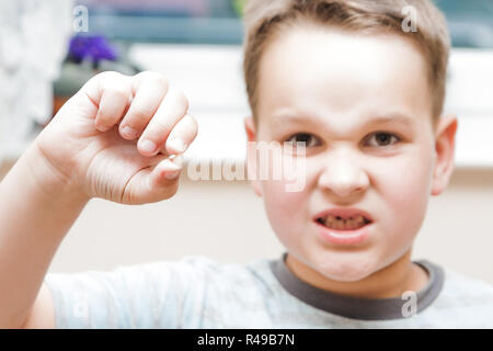 Petit garçon avec une première dent de lait avant déchiré Banque D'Images