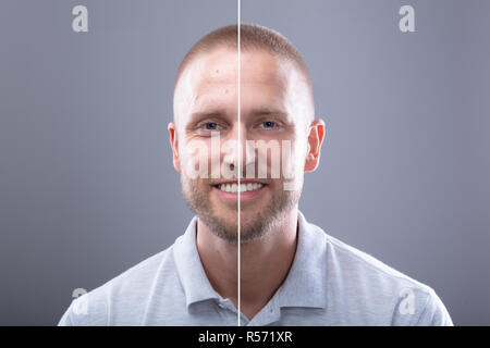 Portrait Of A Smiling Man's Face avant et après intervention cosmétique sur fond gris Banque D'Images