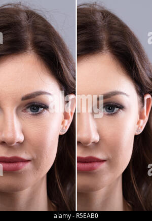 Portrait Of A young woman's Face avant et après intervention cosmétique Banque D'Images