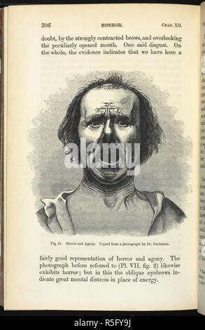 L'horreur et de l'agonie. Illustration dans 'l'expression des émotions chez l'homme et les animaux'. Copié à partir d'une photo par le Dr Langlois. L'expression des émotions chez l'homme et les animaux. Londres, 1873. Source : 7005.df.6, page 306. Auteur : Darwin, Charles. Banque D'Images