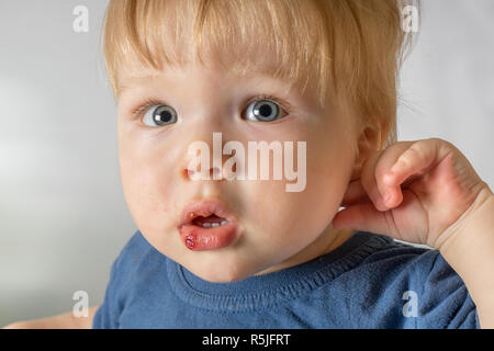 Close-up of baby blessé après avoir chuté à lèvres meurtries. Traumatismes des enfants concept. Banque D'Images