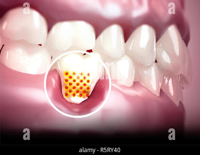 La bouche, des dents, des gencives. Dents sensibles, retrait de la gencive. La sensibilité dentaire. Laboratoire dentaire. Le rendu 3D Banque D'Images