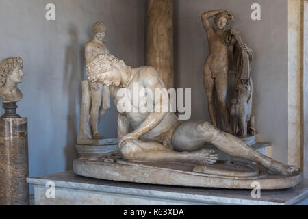 Galate mourant, Musées du Capitole, Rome, Italie Banque D'Images