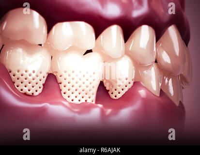 La bouche, des dents, des gencives. Dents sensibles, retrait de la gencive. La sensibilité dentaire. Laboratoire dentaire. Le rendu 3D Banque D'Images