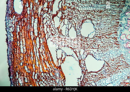 La carotte à l'échelle 100x Banque D'Images