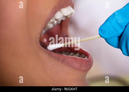 Dentiste Faire test de salive sur la bouche avec du coton-tige Banque D'Images