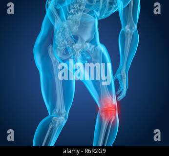 Attaque de la douleur au genou, l'homme souffrant de la moelle au genou. 3D illustration Banque D'Images